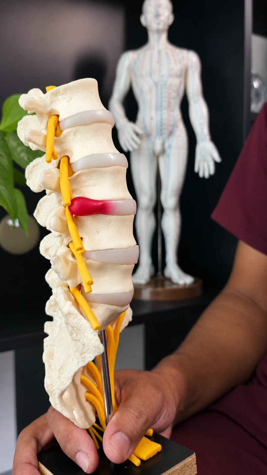Modelo anatômico da coluna vertebral nas mãos de Erilson, com nervos e discos representados